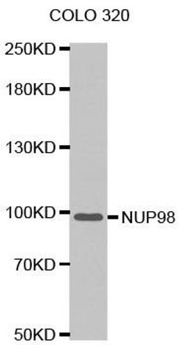 Western blot analysis of extracts of COLO 320 cells tissue using NUP98 antibody