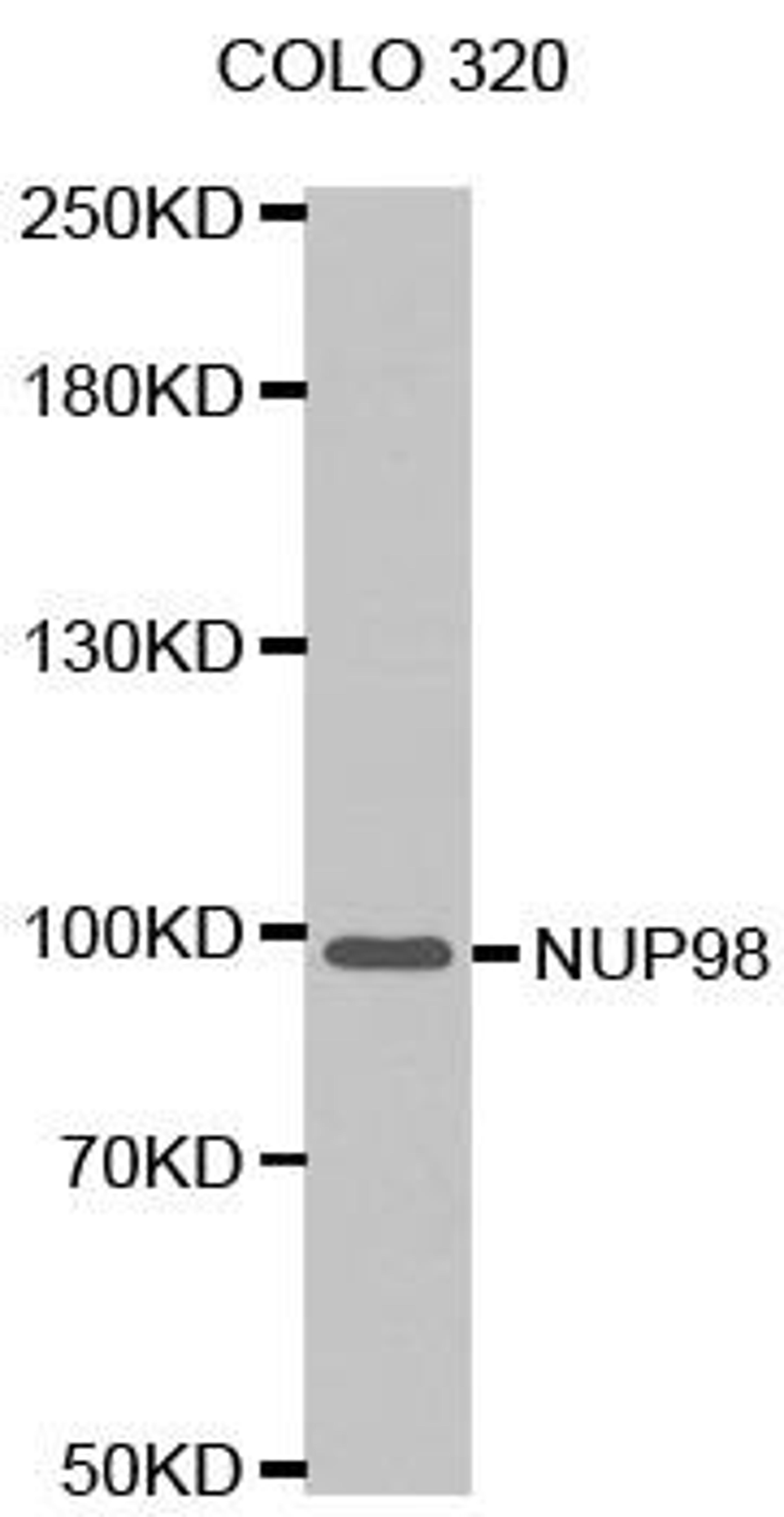 Western blot analysis of extracts of COLO 320 cells tissue using NUP98 antibody