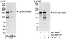 Detection of human USP19/ZMYND9 by western blot and immunoprecipitation.