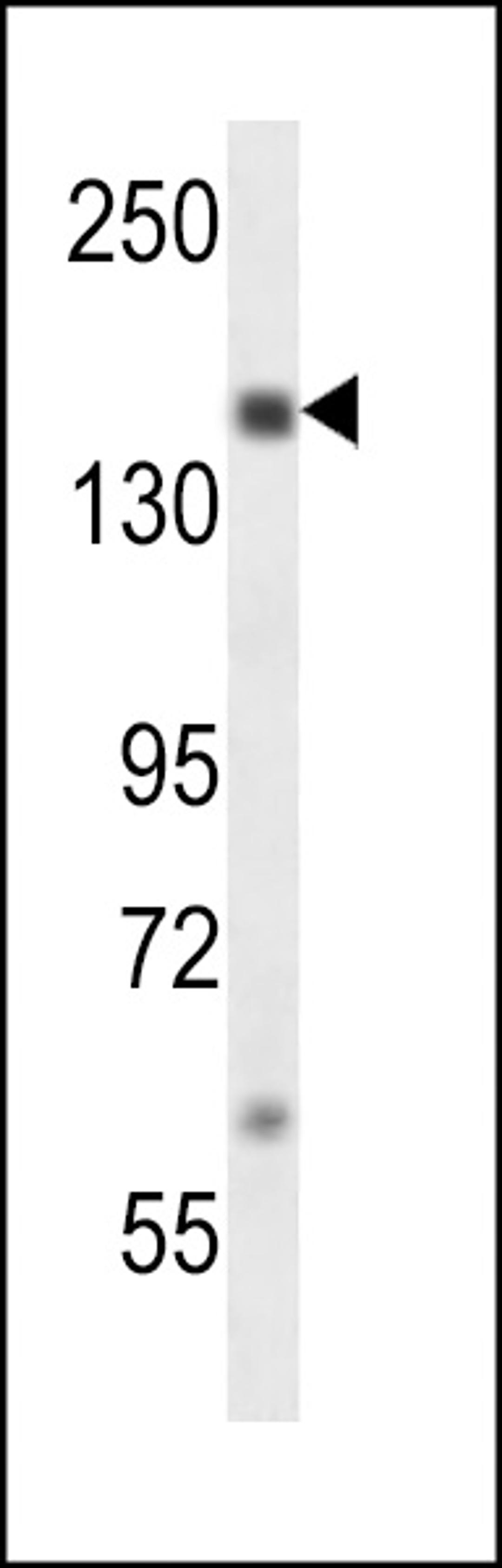 Western blot analysis in MDA-MB231 cell line lysates (35ug/lane).