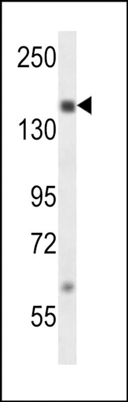 Western blot analysis in MDA-MB231 cell line lysates (35ug/lane).