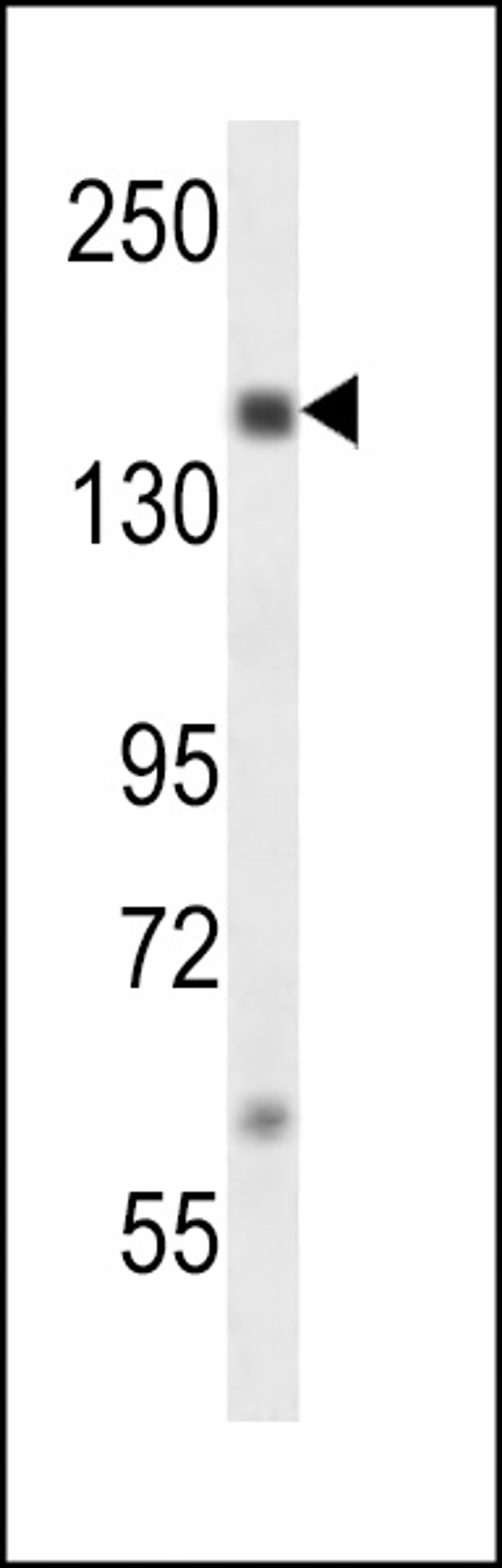 Western blot analysis in MDA-MB231 cell line lysates (35ug/lane).