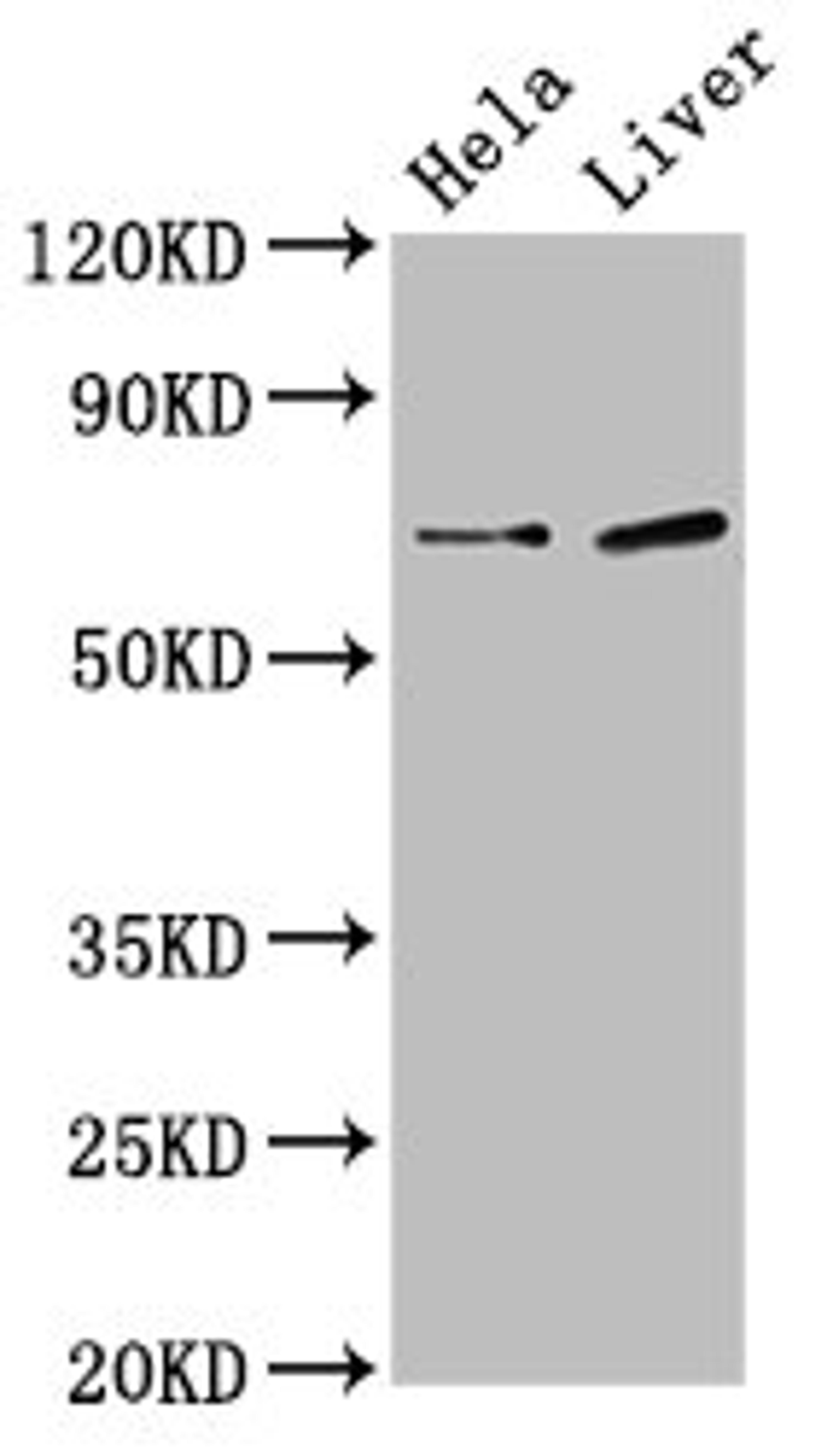 Western Blot. Positive WB detected in: Hela whole cell lysate, Rat liver tissue. All lanes: SSX2IP antibody at 3µg/ml. Secondary. Goat polyclonal to rabbit IgG at 1/50000 dilution. Predicted band size: 72, 66, 69 kDa. Observed band size: 72 kDa