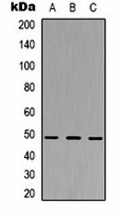 Western blot analysis of  Hela (Lane1), NIH3T3 (Lane2), PC12 (Lane3) whole cell lysates using MKK5 antibody