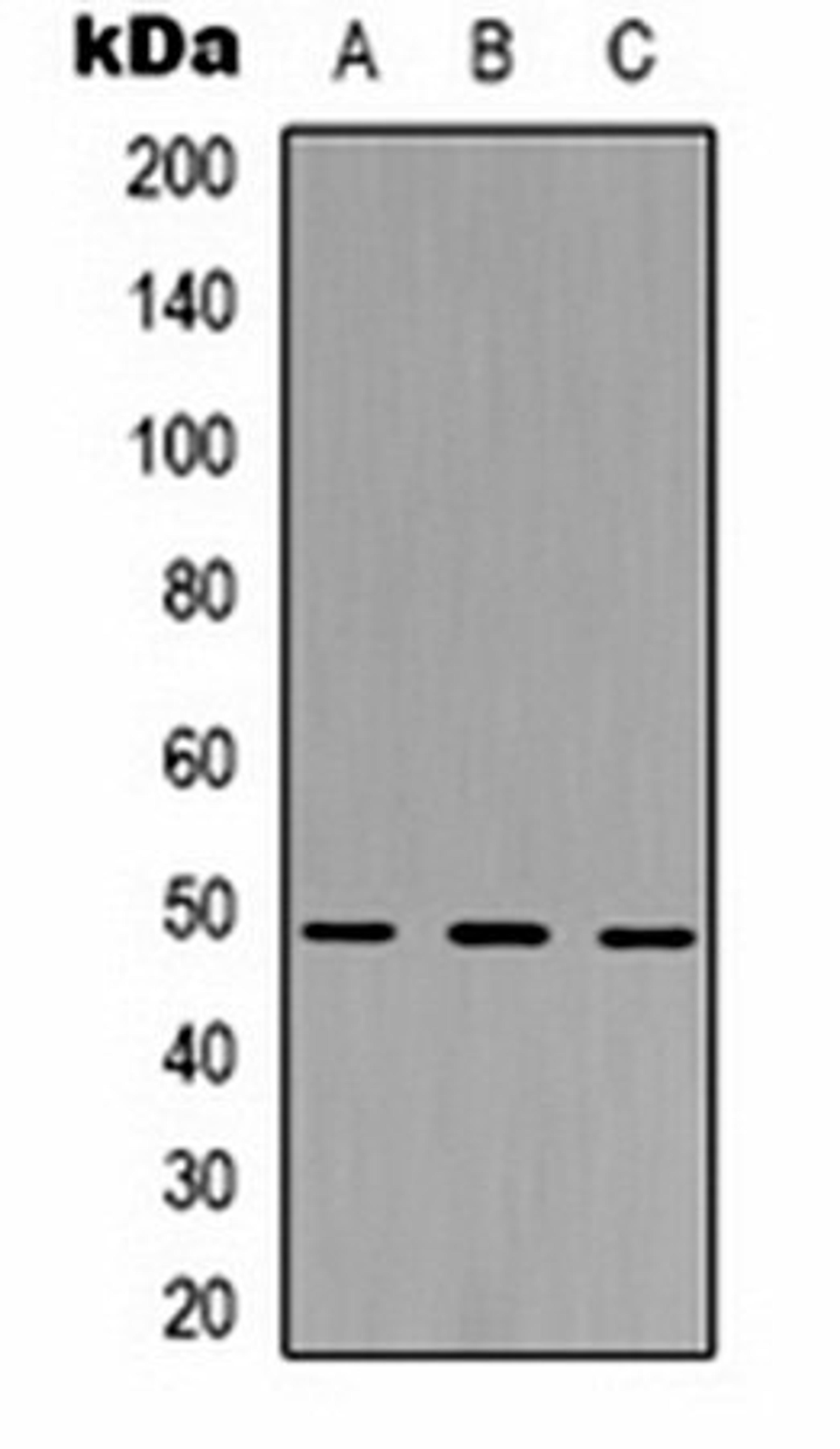 Western blot analysis of Hela (Lane1), NIH3T3 (Lane2), PC12 (Lane3) whole cell lysates using MKK5 antibody