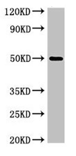 Western Blot. Positive WB detected in: K562 whole cell lysate. All lanes: SGMS1 antibody at 4µg/ml. Secondary. Goat polyclonal to rabbit IgG at 1/50000 dilution. Predicted band size: 49, 26 kDa. Observed band size: 49 kDa