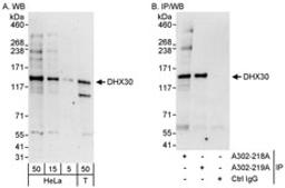 Detection of human DHX30 by western blot and immunoprecipitation.