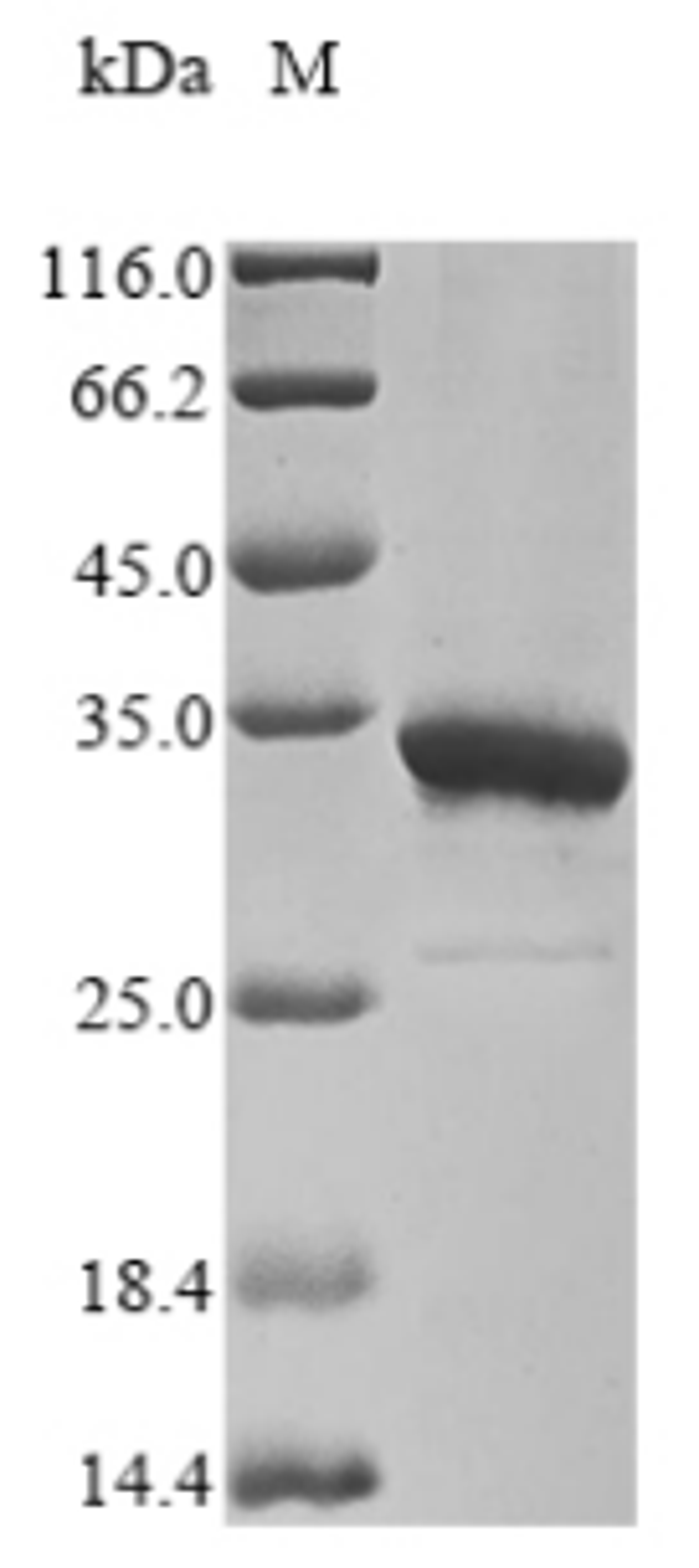 (Tris-Glycine gel) Discontinuous SDS-PAGE (reduced) with 5% enrichment gel and 15% separation gel.