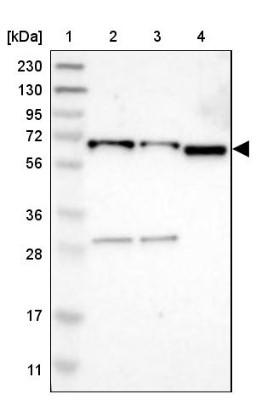 Western Blot: EIF2AK1 Antibody [NBP1-83210] - Lane 1: Marker [kDa] 230, 130, 95, 72, 56, 36, 28, 17, 11<br/>Lane 2: Human cell line RT-4<br/>Lane 3: Human cell line U-251MG sp<br/>Lane 4: Human plasma (IgG/HSA depleted)