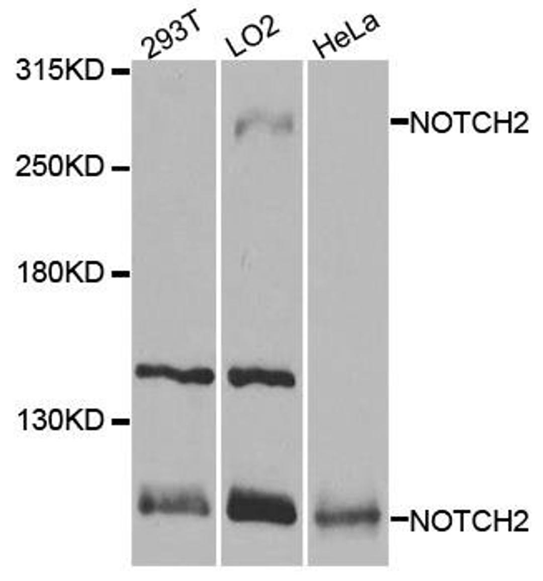 Western blot analysis of extracts of various cell lines using NOTCH2 antibody