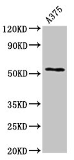 Western Blot. Positive WB detected in: A375 whole cell lysate. All lanes: CPE antibody at 2.7µg/ml. Secondary. Goat polyclonal to rabbit IgG at 1/50000 dilution. Predicted band size: 54, 50 kDa. Observed band size: 54 kDa