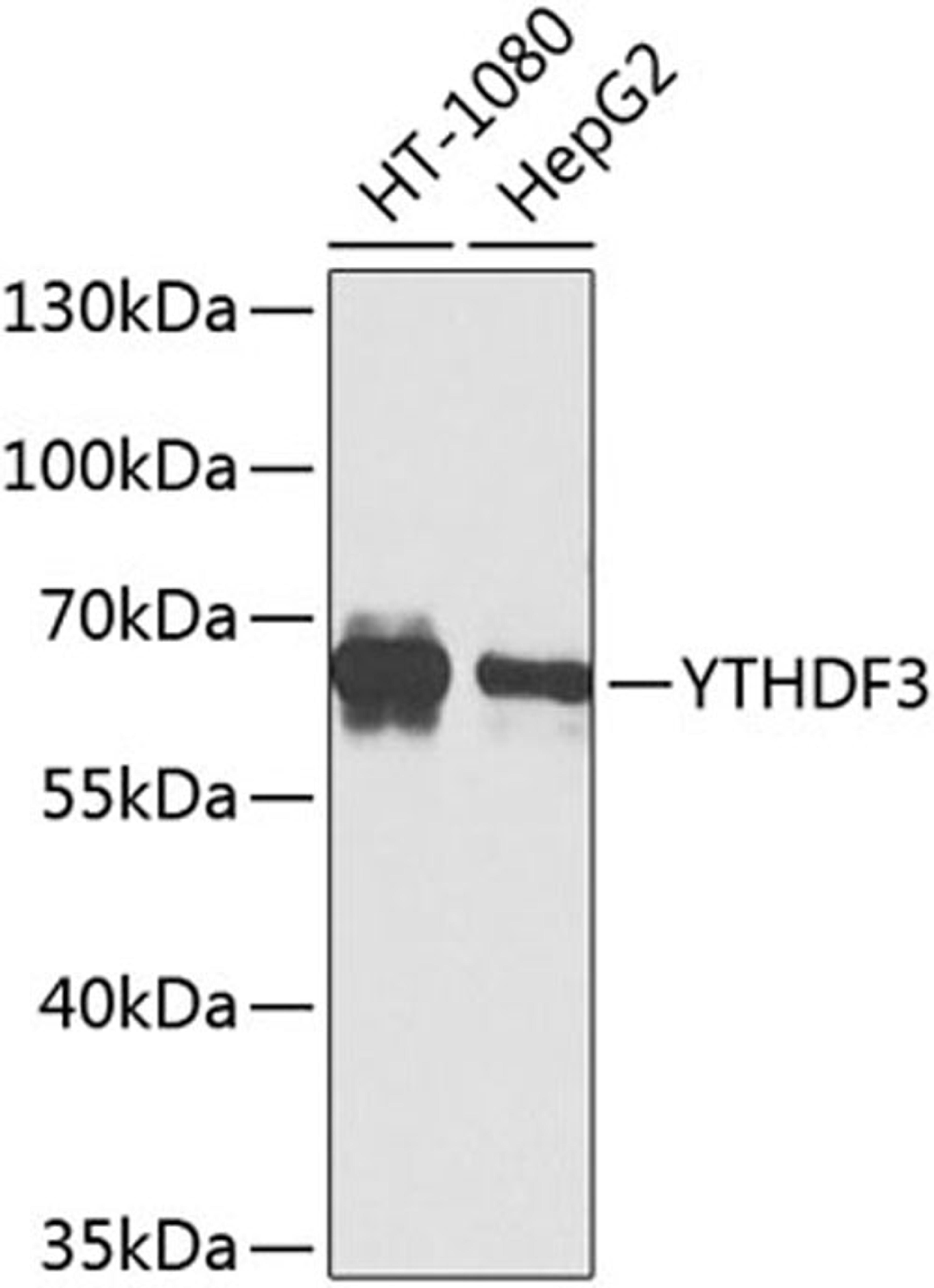 Western blot - YTHDF3 Antibody (A8395)