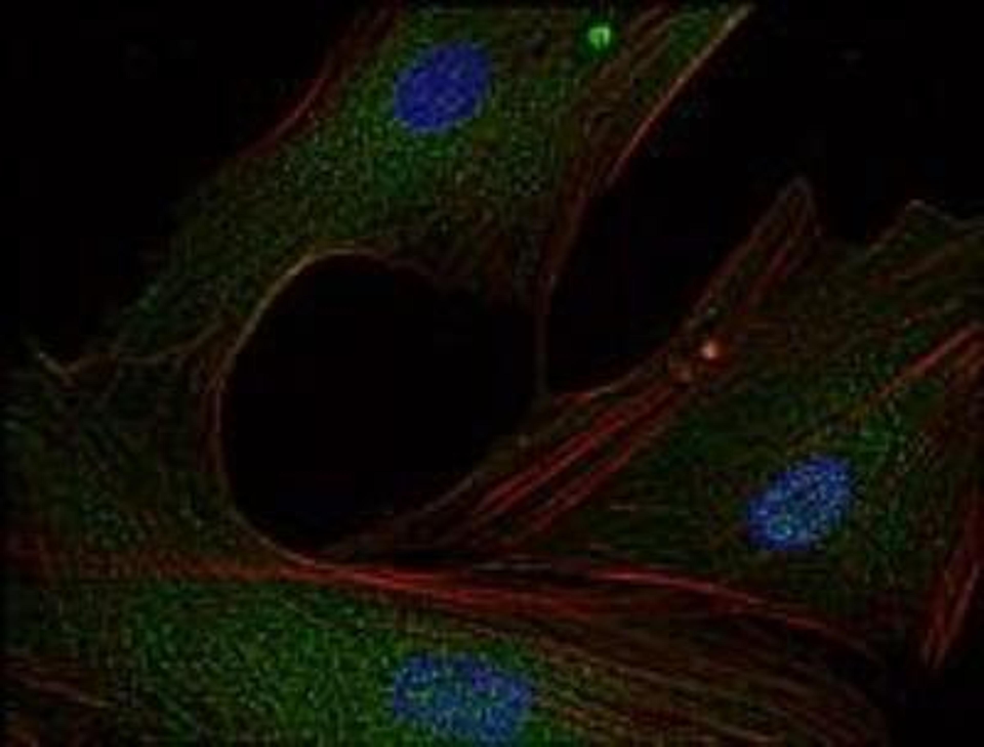 Immunocytochemistry/Immunofluorescence: Fyn Antibody (FYN-01) [NB500-517] - Staining of Fyn in human primary fibroblasts using anti-Fyn (FYN-01; green). Actin cytoskeleton was decorated by phalloidin (red) and cell nuclei stained with DAPI (blue).