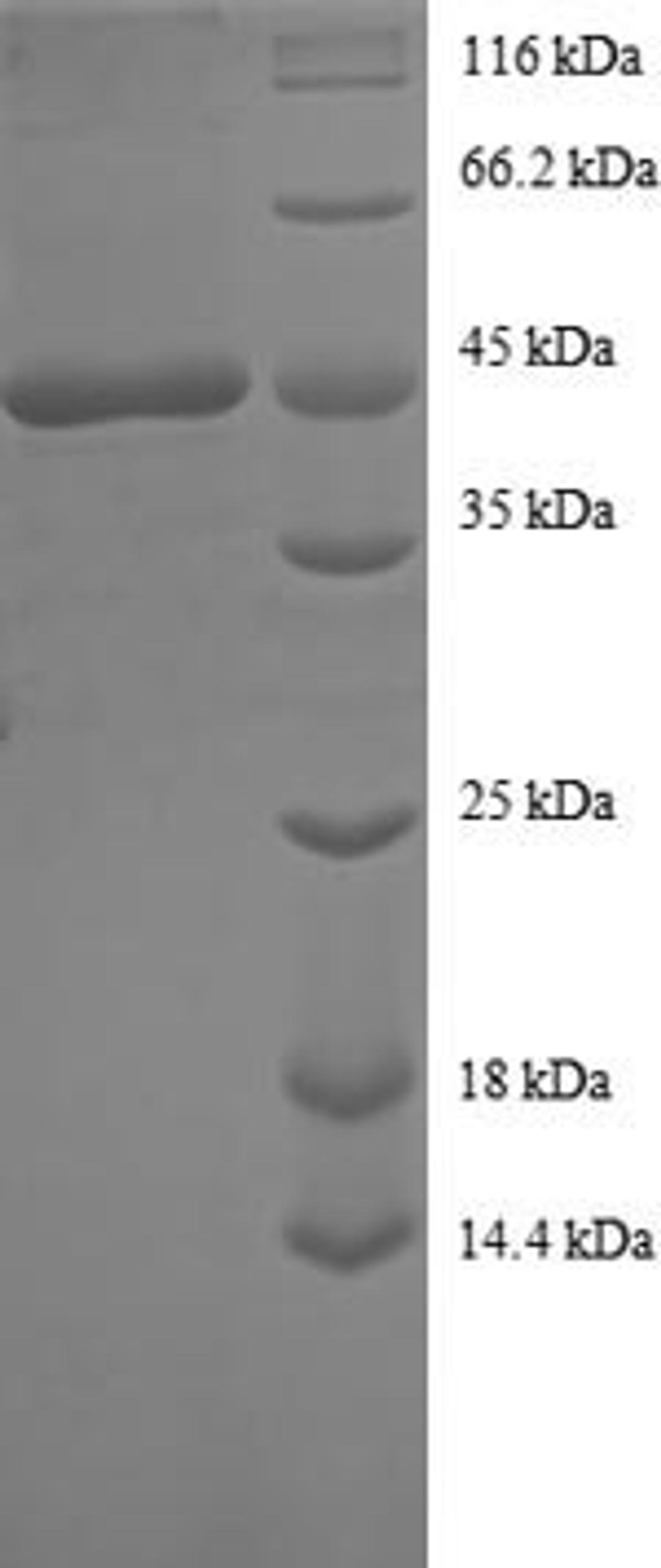 (Tris-Glycine gel) Discontinuous SDS-PAGE (reduced) with 5% enrichment gel and 15% separation gel.