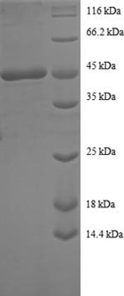 (Tris-Glycine gel) Discontinuous SDS-PAGE (reduced) with 5% enrichment gel and 15% separation gel.