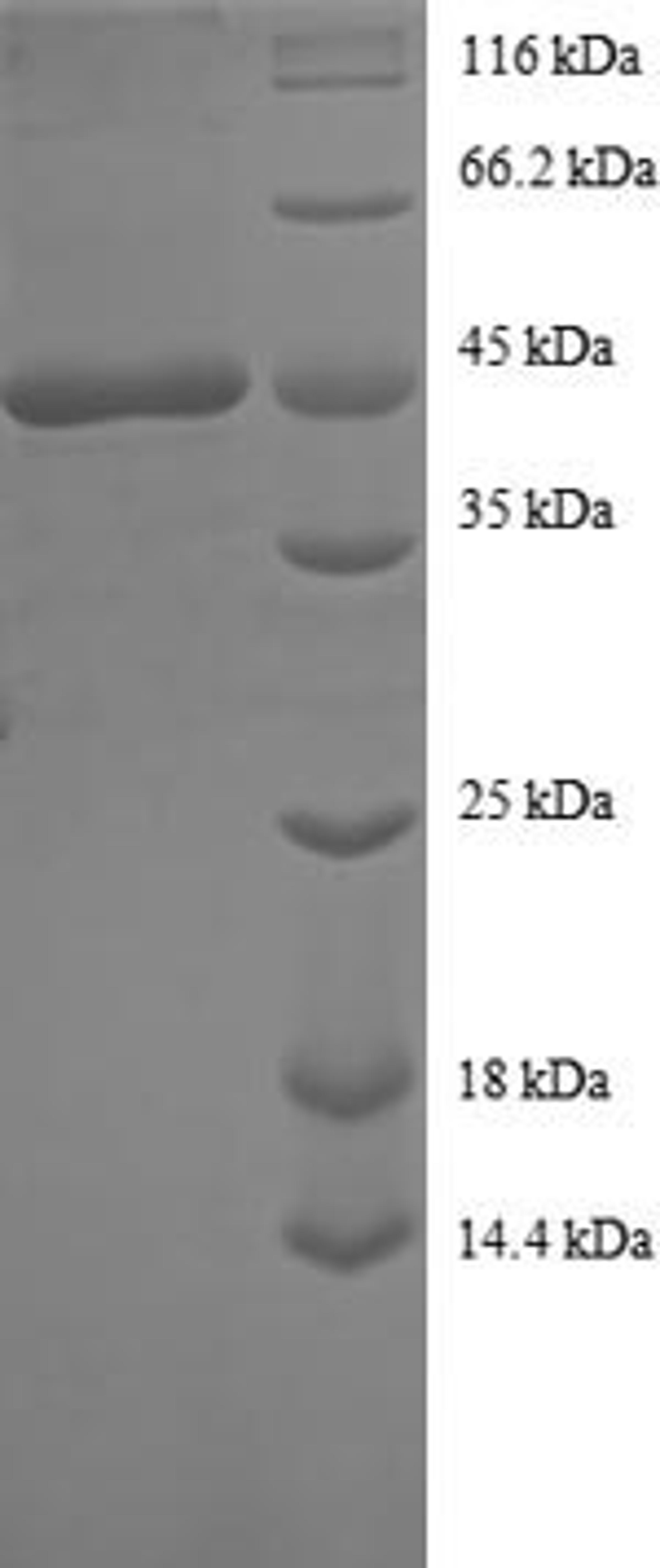 (Tris-Glycine gel) Discontinuous SDS-PAGE (reduced) with 5% enrichment gel and 15% separation gel.