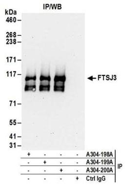 Detection of human FTSJ3 by western blot of immunoprecipitates.