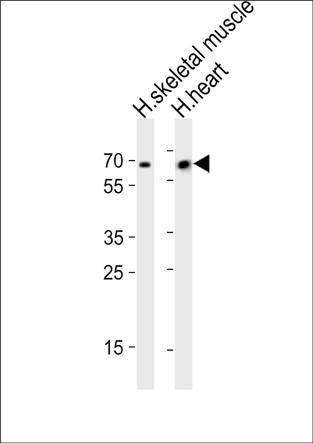 Western blot analysis of lysates from human skeletal muscle and human heart tissue (from left to right), using Cry2 Antibody (R579) at 1:1000 at each lane.