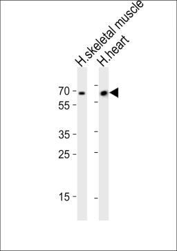 Western blot analysis of lysates from human skeletal muscle and human heart tissue (from left to right), using Cry2 Antibody (R579) at 1:1000 at each lane.