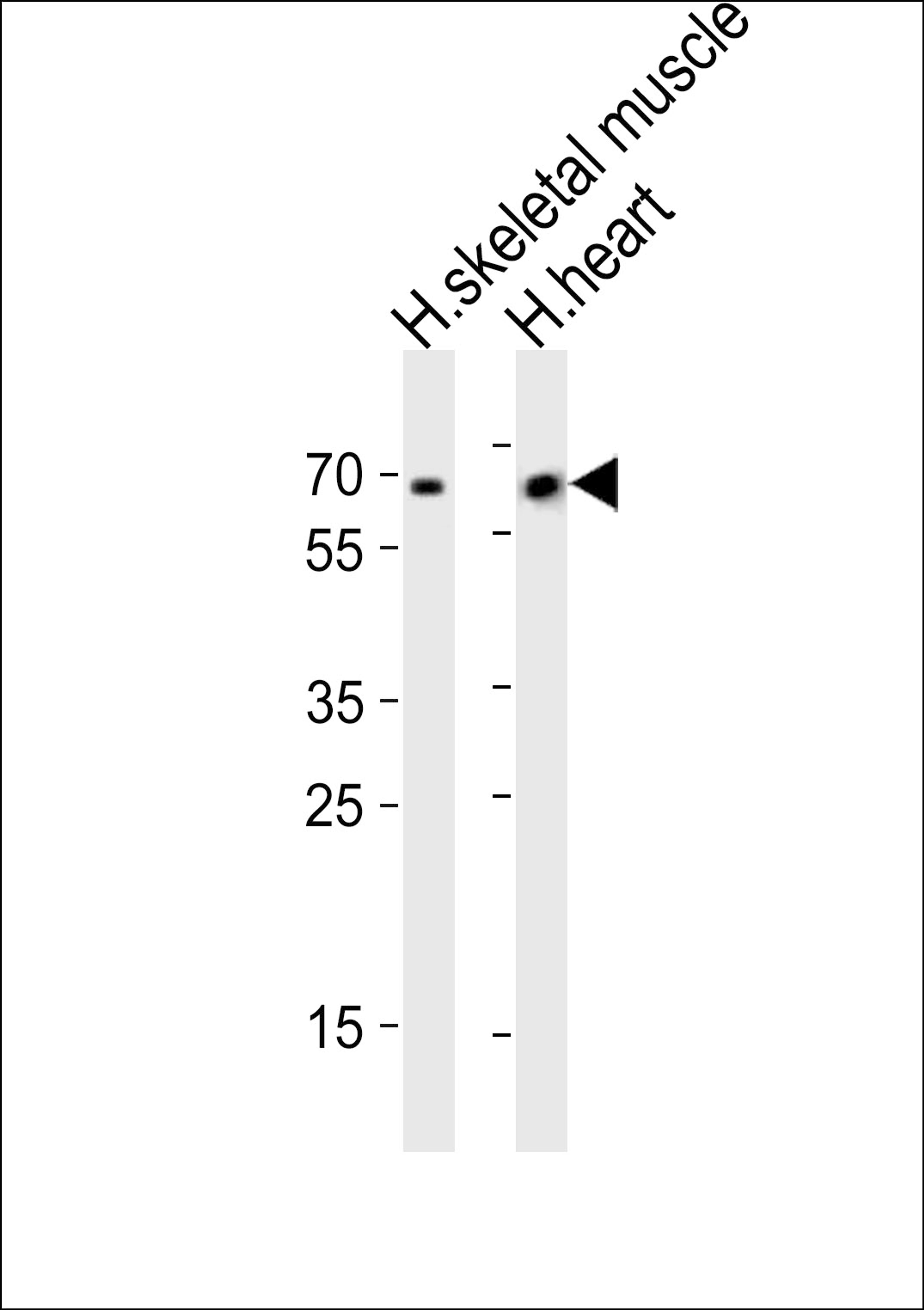 Western blot analysis of lysates from human skeletal muscle and human heart tissue (from left to right), using Cry2 Antibody (R579) at 1:1000 at each lane.