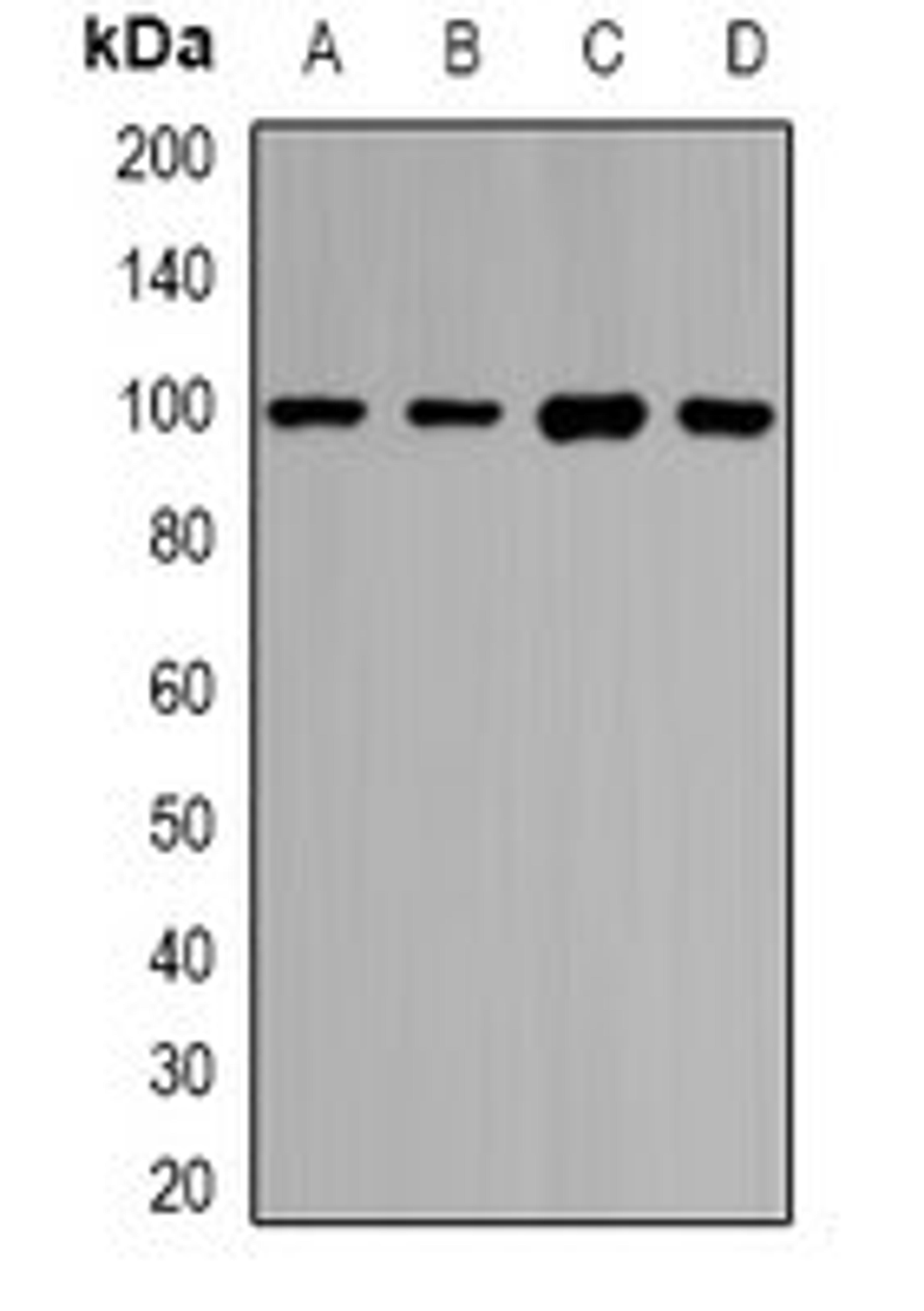 Western blot analysis of HepG2 (Lane1), SKOV3 (Lane2), mouse testis (Lane3), rat testis (Lane4) whole cell lysates using PIWIL1 antibody