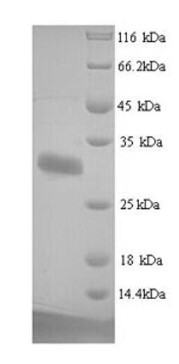 (Tris-Glycine gel) Discontinuous SDS-PAGE (reduced) with 5% enrichment gel and 15% separation gel.