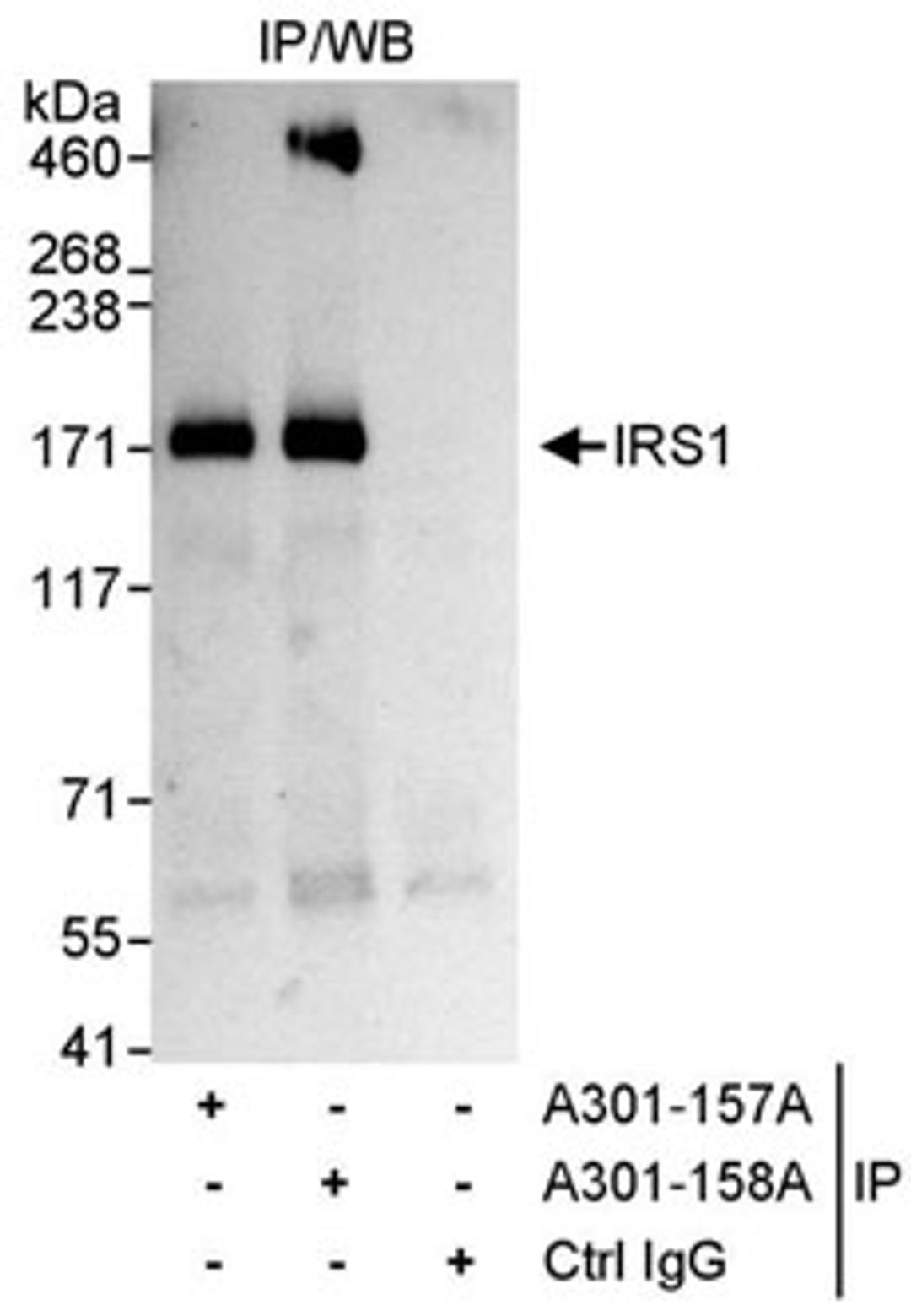 Detection of human IRS1 by western blot of immunoprecipitates.