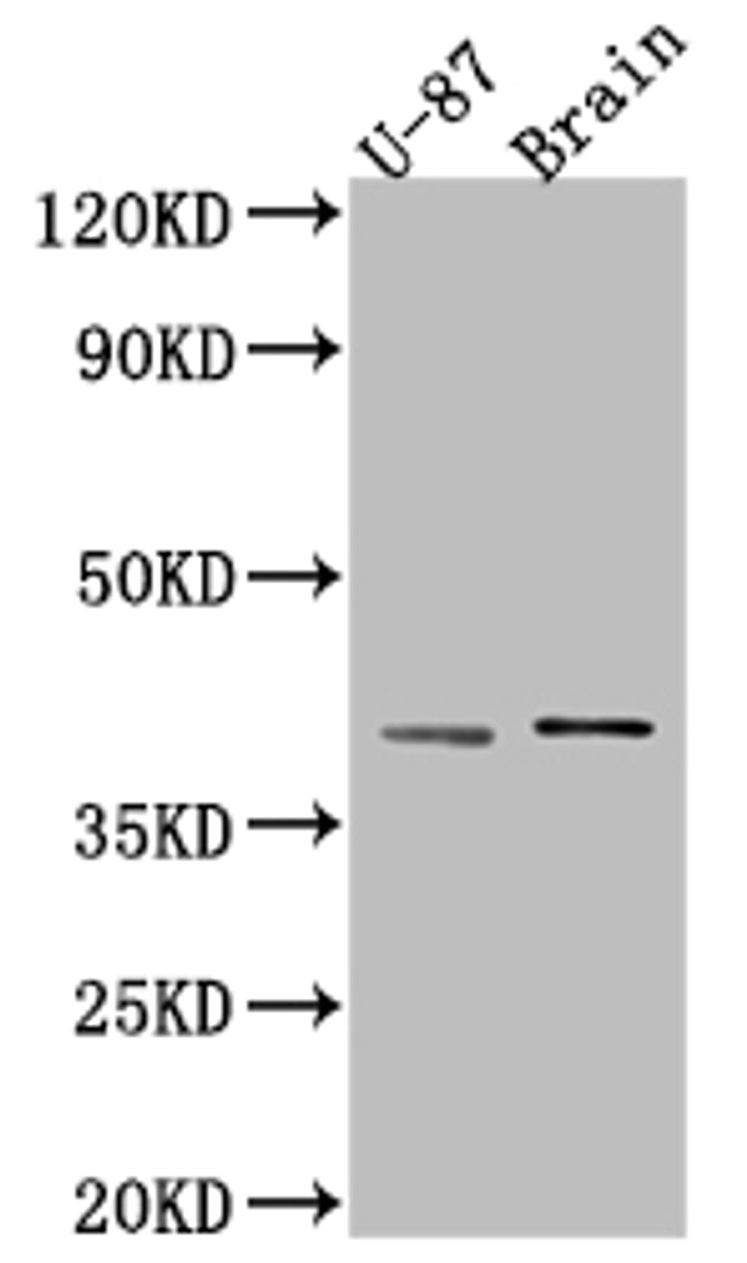 Western Blot. Positive WB detected in: U-87 whole cell lysate, Rat Brain whole cell lysate. All lanes: NGF antibody at 1:1000. Secondary. Goat polyclonal to rabbit IgG at 1/50000 dilution. Predicted band size: 27 kDa. Observed band size: 39 kDa. 