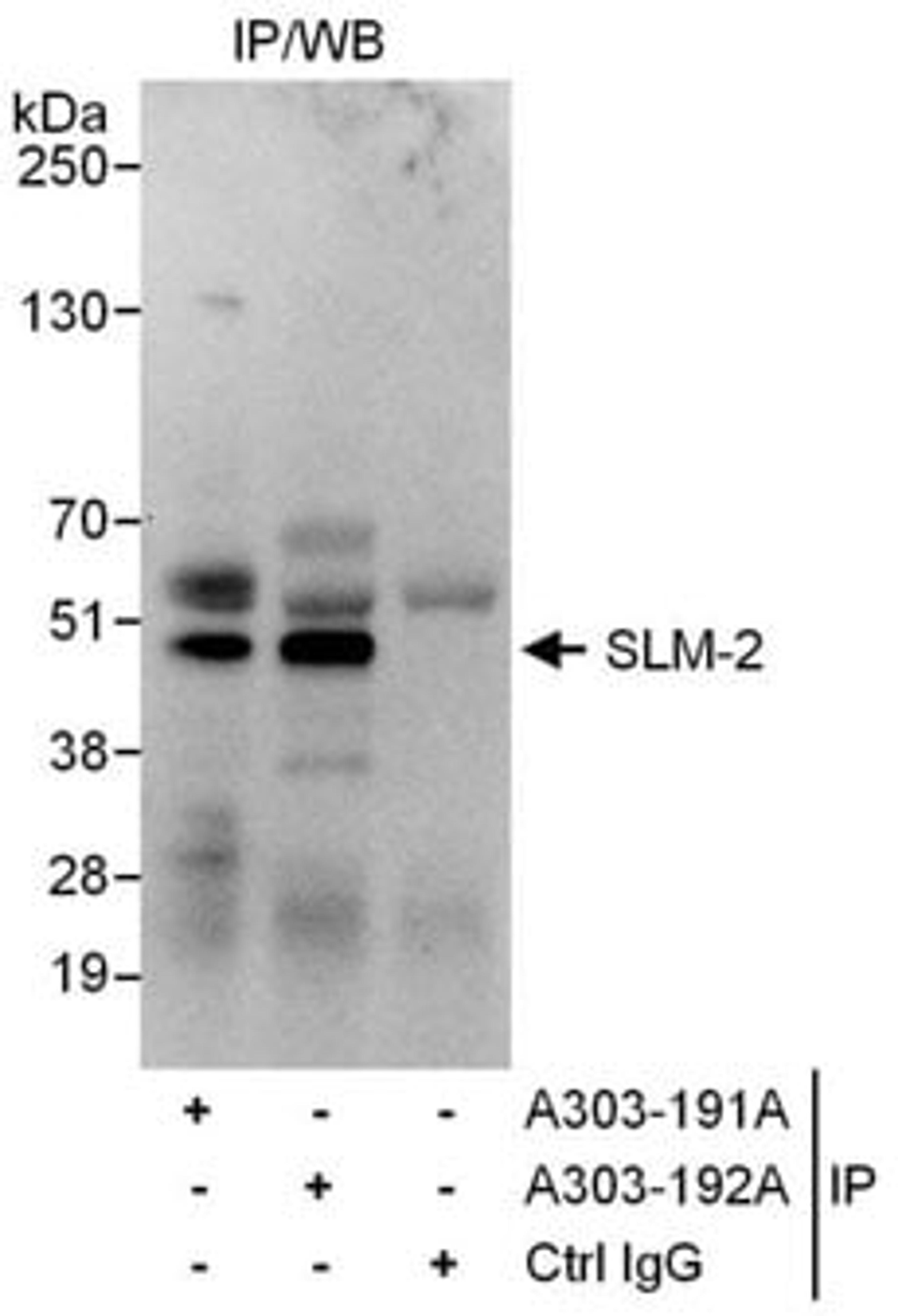 Detection of human SLM-2 by western blot of immunoprecipitates.