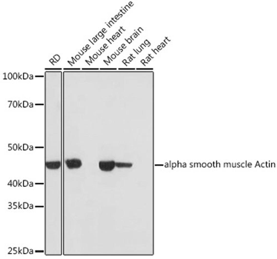 Western blot - alpha smooth muscle Actin antibody (A17910)