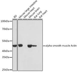 Western blot - alpha smooth muscle Actin antibody (A17910)