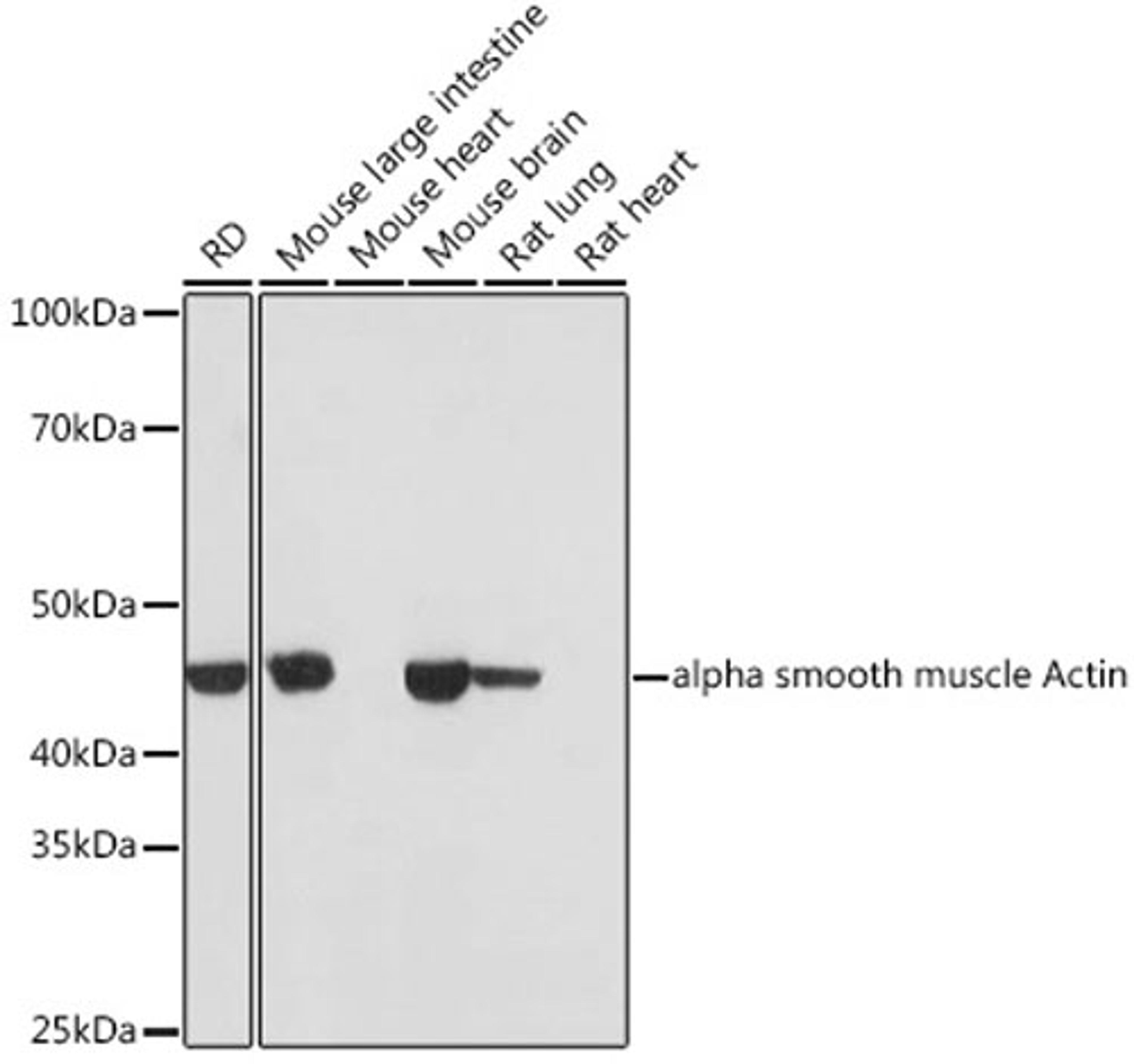 Western blot - alpha smooth muscle Actin antibody (A17910)