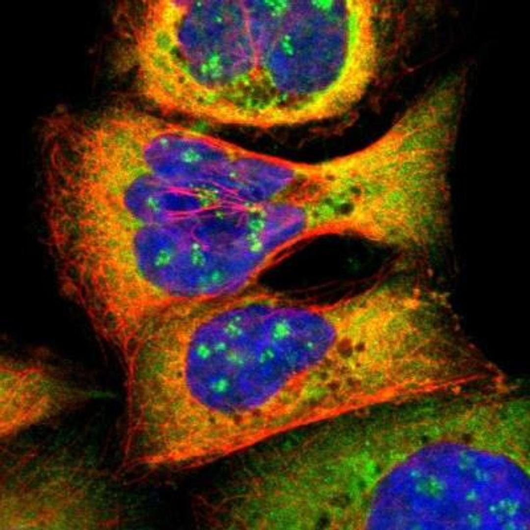 Immunocytochemistry/Immunofluorescence: CTTNBP2NL Antibody [NBP1-84171] - Staining of human cell line A-431 shows positivity in nucleoli & cytoplasm.