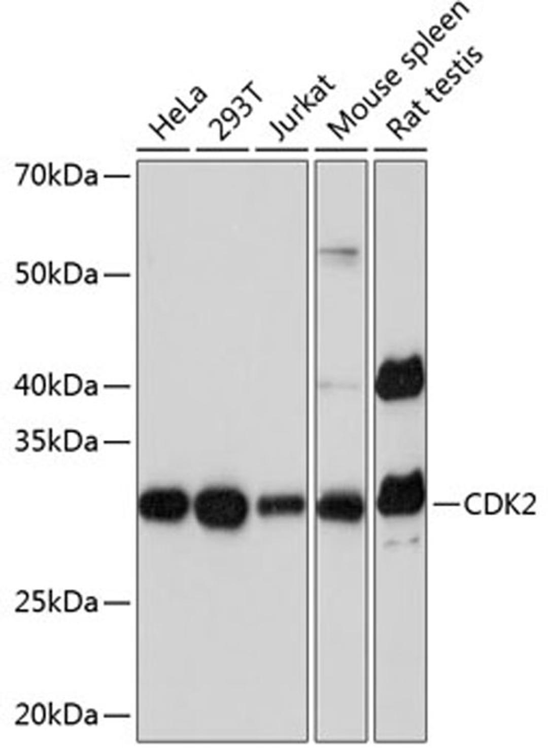 Western blot - CDK2 Rabbit mAb (A0094)