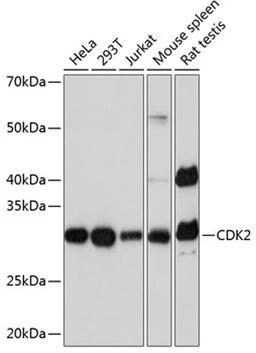 Western blot - CDK2 Rabbit mAb (A0094)