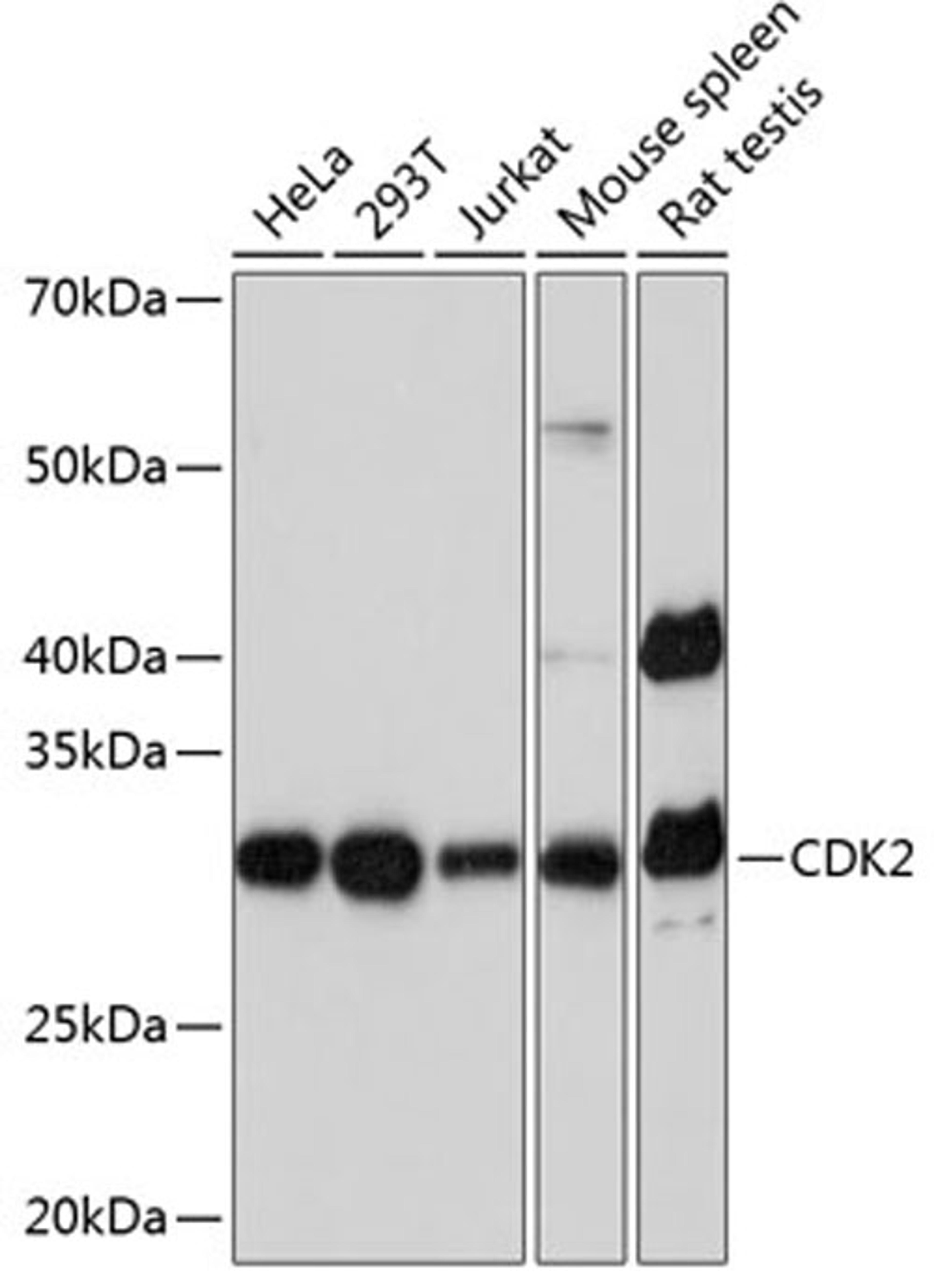 Western blot - CDK2 Rabbit mAb (A0094)