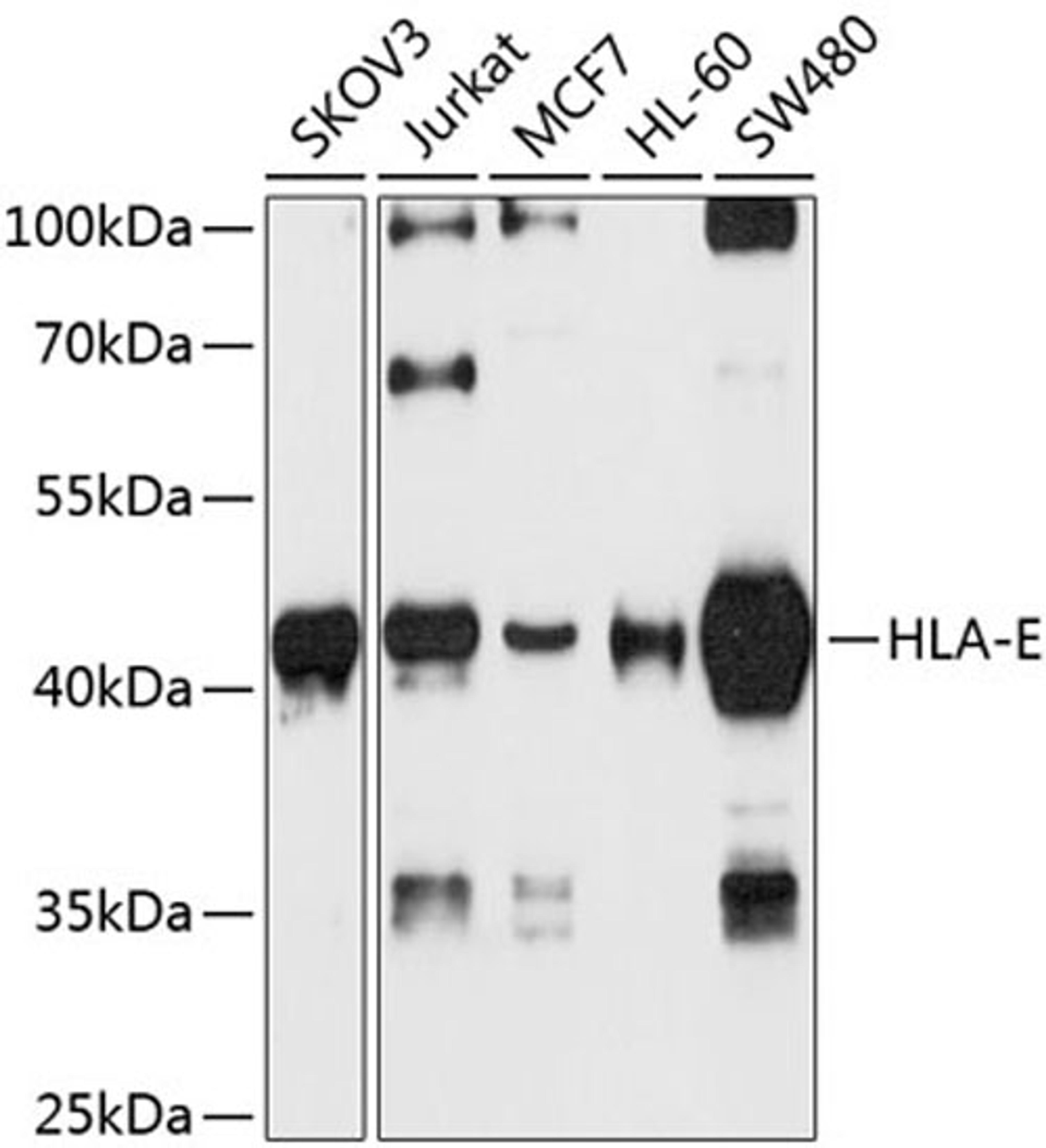 Western blot - HLA-E antibody (A8429)