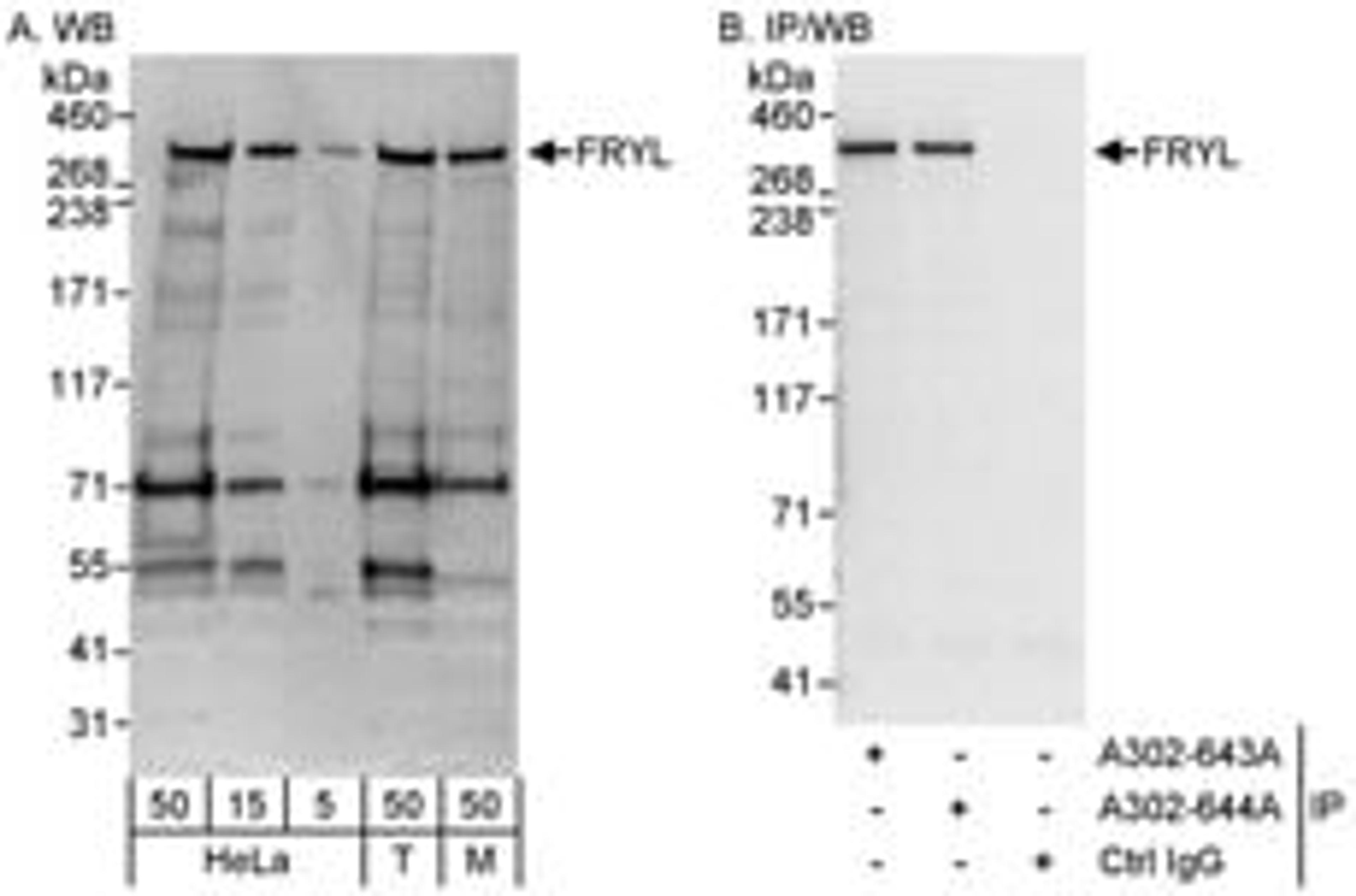 Detection of human and mouse FRYL by western blot (h&m) and immunoprecipitation (h).