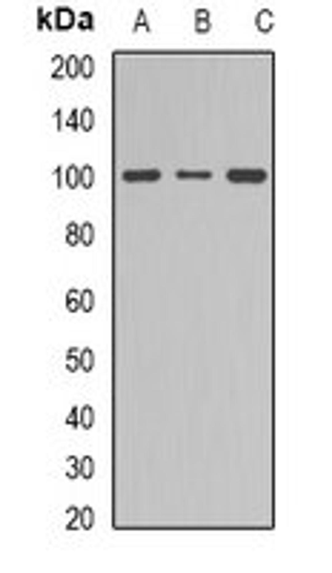 Western blot analysis of NIH3T3 (Lane 1), mouse brain (Lane 2), PC12 (Lane 3) whole cell lysates using Dynamin 1 antibody