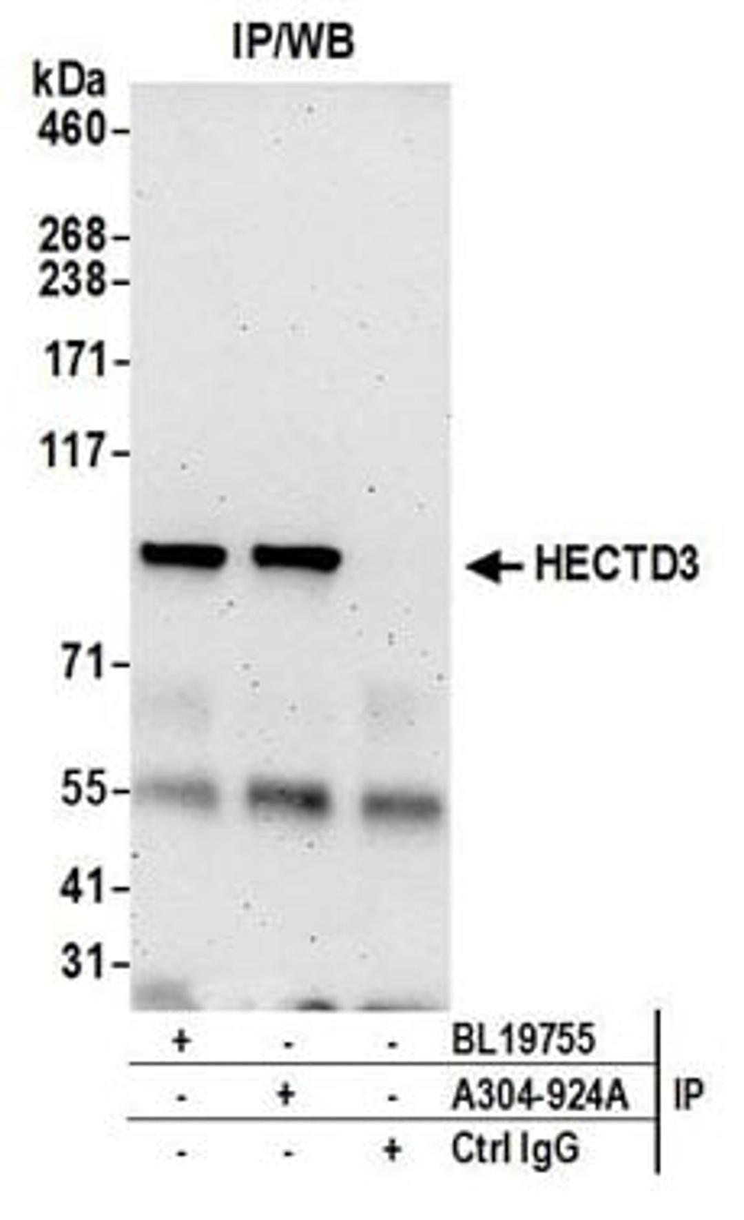 Detection of human HECTD3 by western blot of immunoprecipitates.