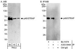 Detection of human p49/STRAP by western blot and immunoprecipitation.