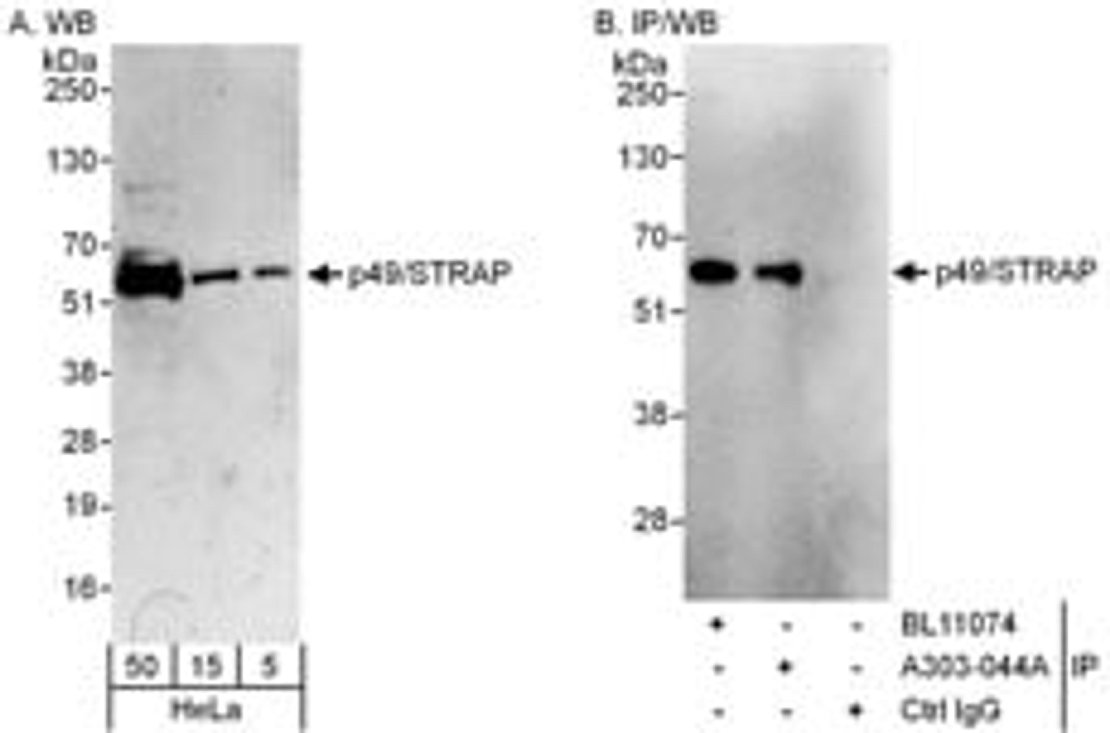 Detection of human p49/STRAP by western blot and immunoprecipitation.