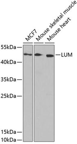 Western blot - LUM antibody (A5352)