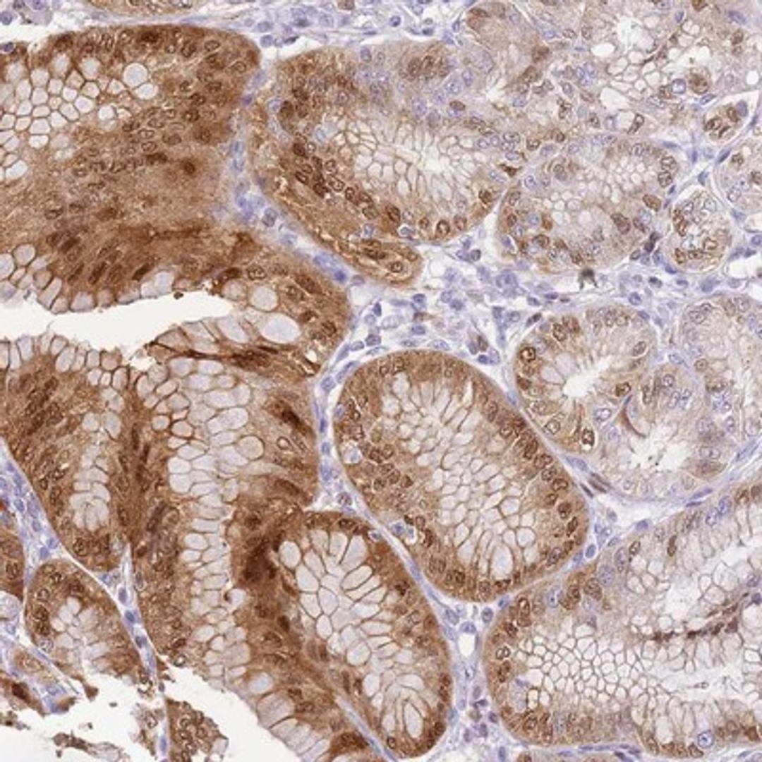 Immunohistochemistry-Paraffin: PORCN Antibody [NBP2-13790] Staining of human stomach, lower shows distinct nuclear and cytoplasmic positivity in glandular cells.