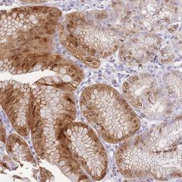 Immunohistochemistry-Paraffin: PORCN Antibody [NBP2-13790] Staining of human stomach, lower shows distinct nuclear and cytoplasmic positivity in glandular cells.