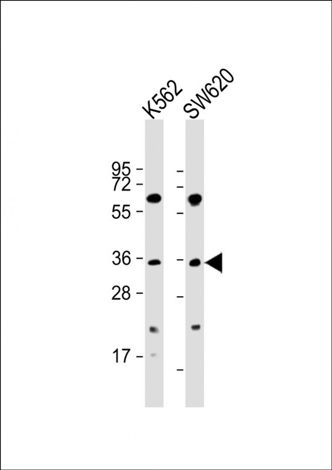 Western Blot at 1:2000 dilution Lane 1: K562 whole cell lysate Lane 2: SW620 whole cell lysate Lysates/proteins at 20 ug per lane.