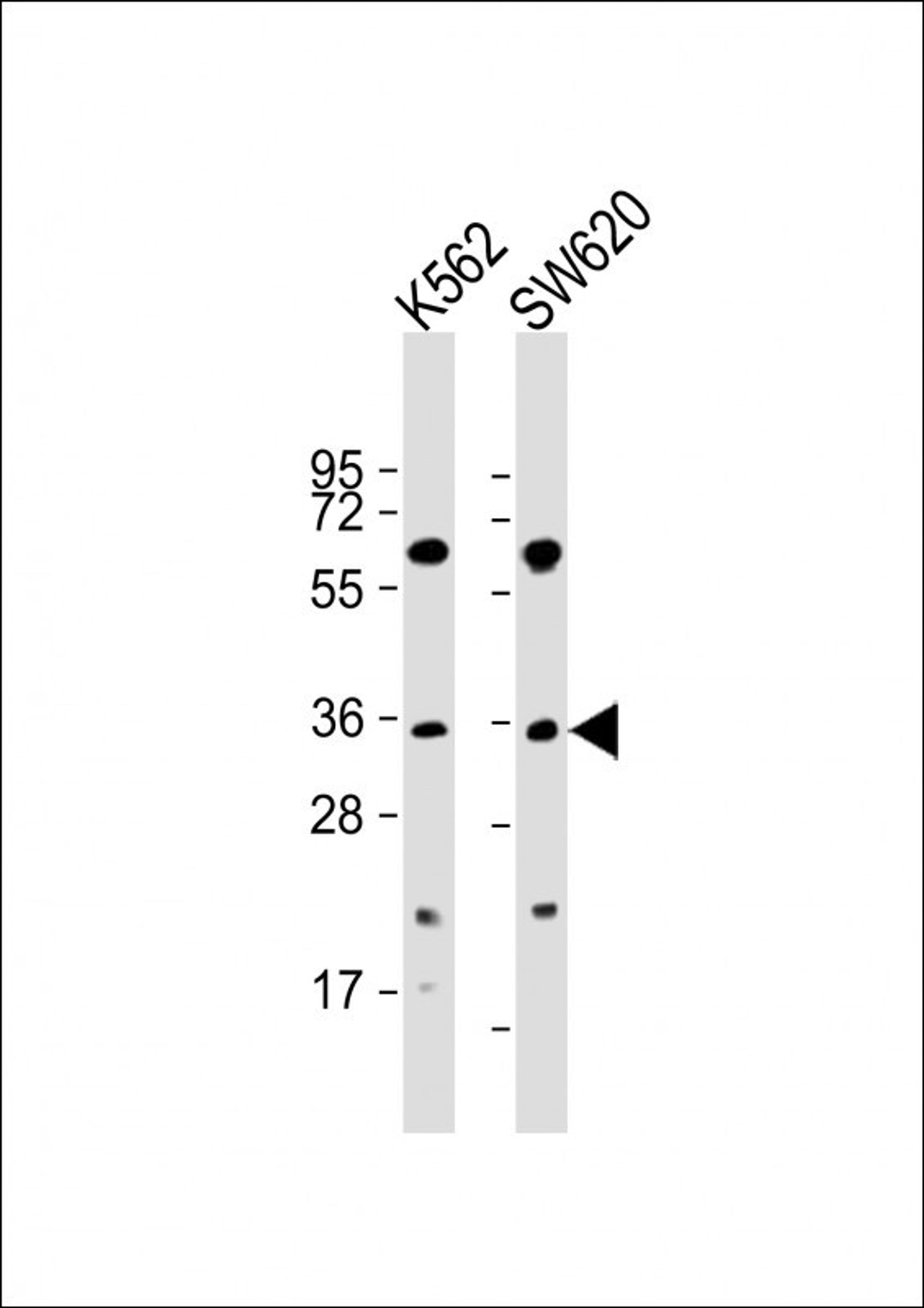 Western Blot at 1:2000 dilution Lane 1: K562 whole cell lysate Lane 2: SW620 whole cell lysate Lysates/proteins at 20 ug per lane.