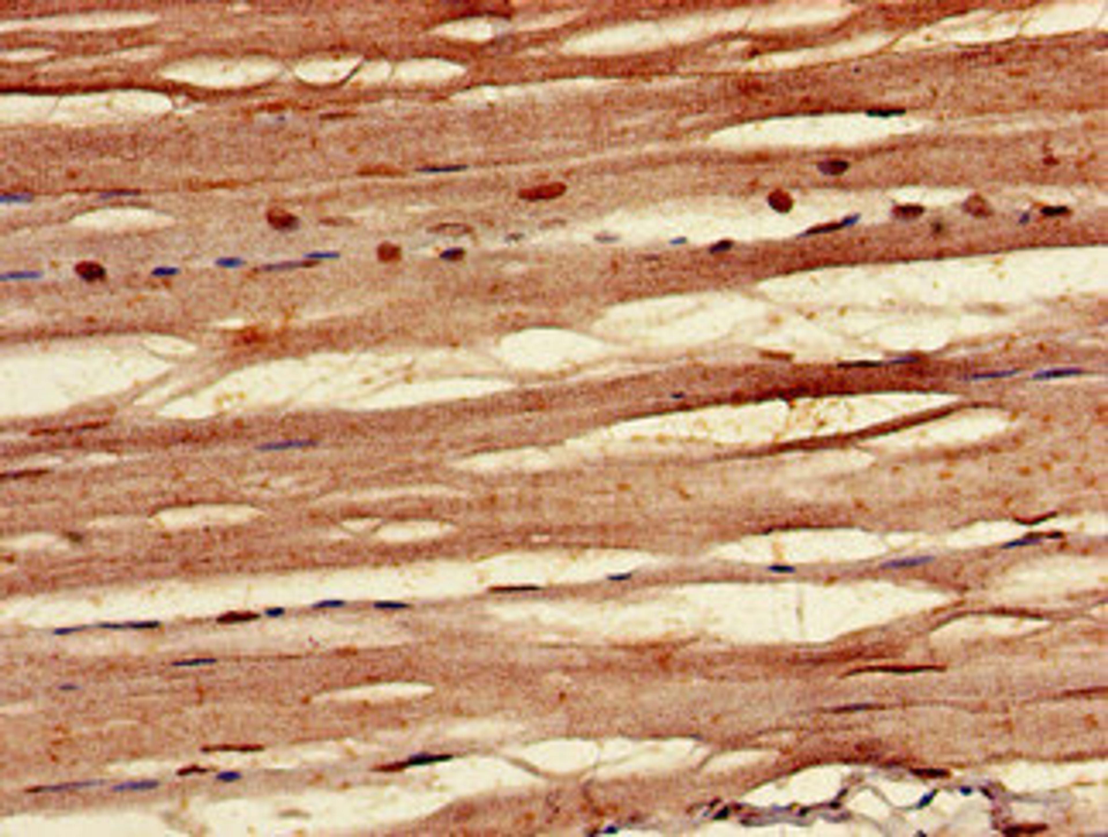 Immunohistochemistry of paraffin-embedded human skeletal muscle tissue using CSB-PA892132LA01HU at dilution of 1:100