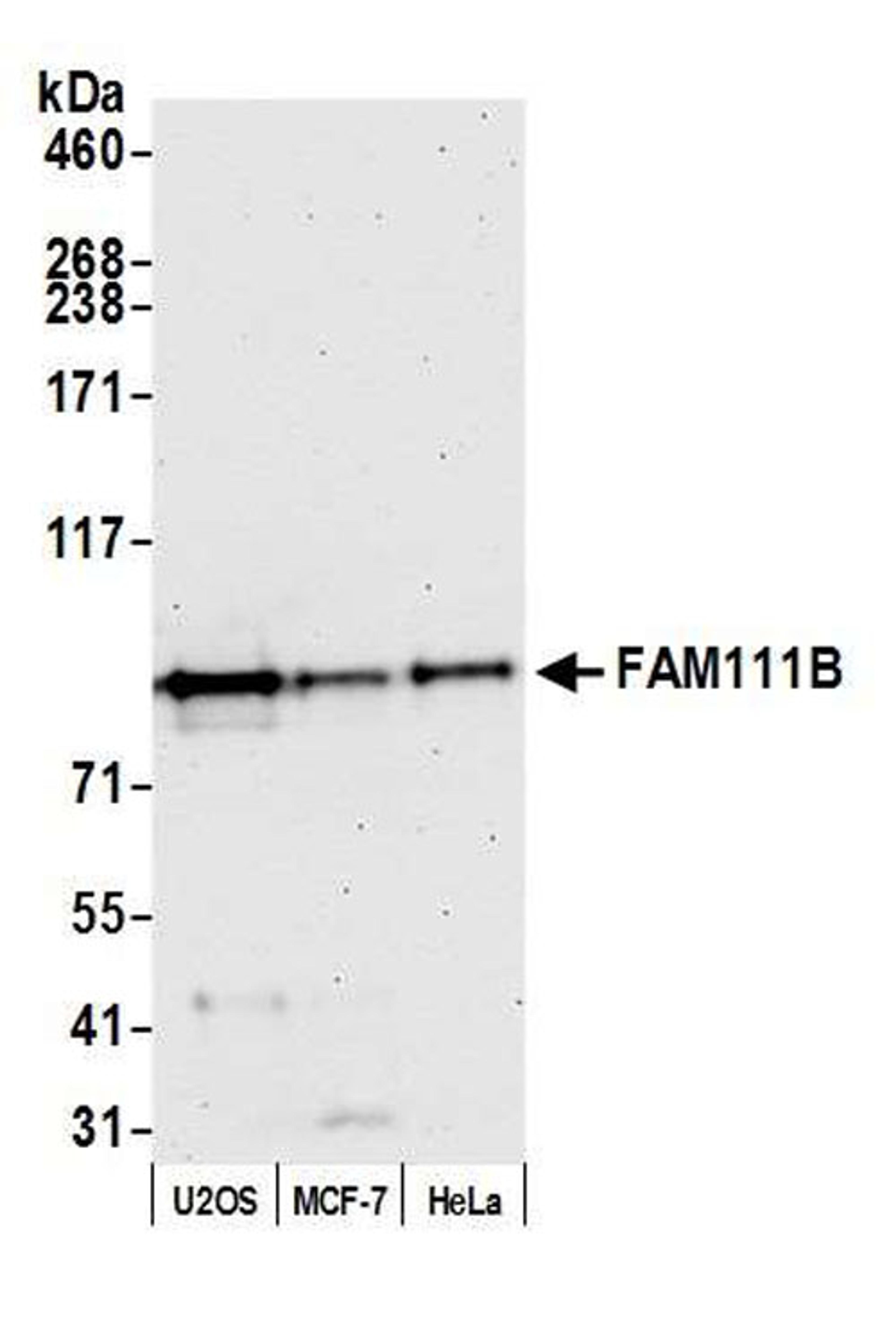 Detection of human FAM111B by WB.