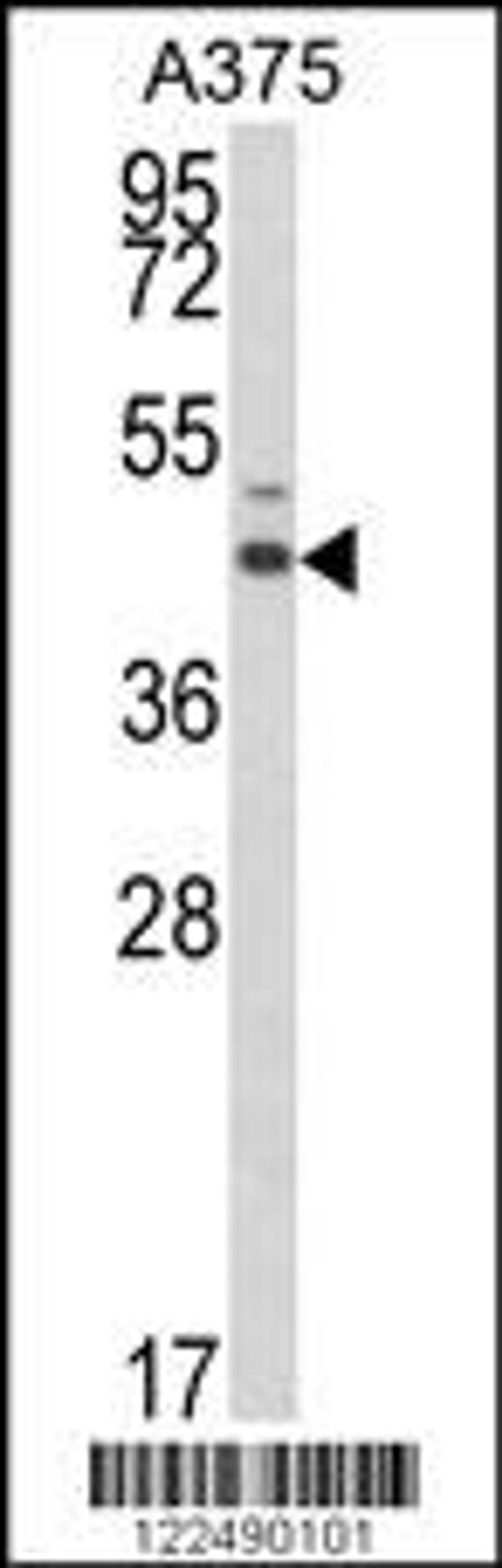 Western blot analysis of ESRRA Antibody in A375 cell line lysates (35ug/lane)